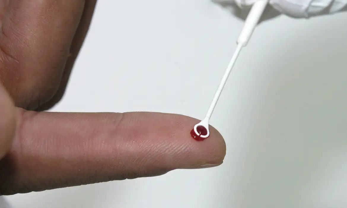 Fiji declara emergência por avanço expressivo de casos de HIV