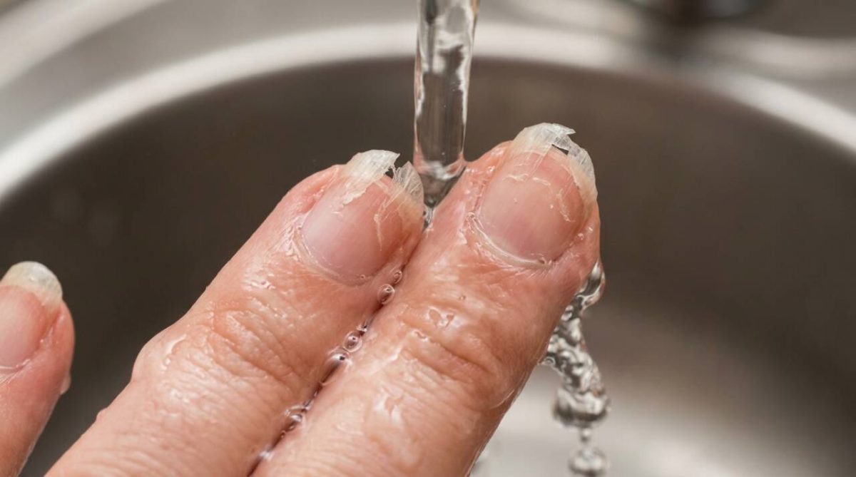 A unha descasca nas pontas e o hábito de usar água quente pode estar contribuindo para a fragilidade
