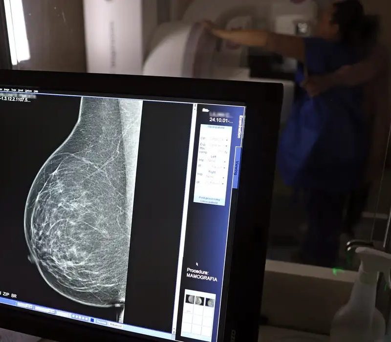 Outubro rosa 2026 foca no combate ao câncer em mulheres negras