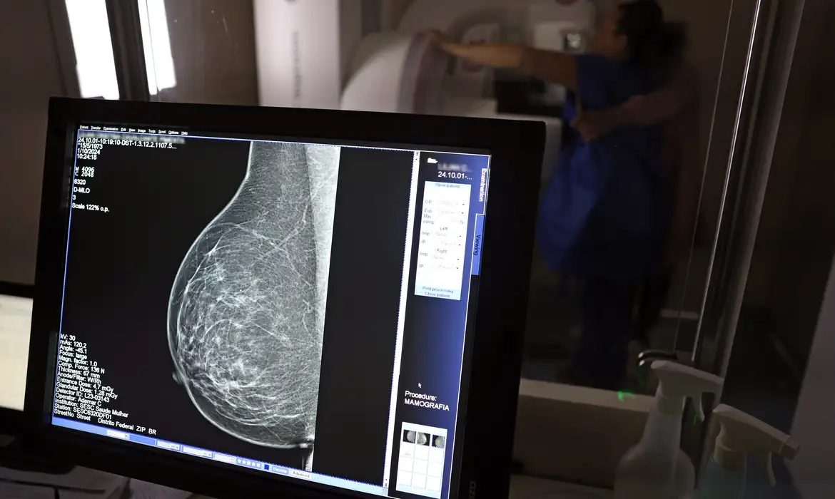 Controle do câncer da mulher negra é destaque do Outubro Rosa 2026