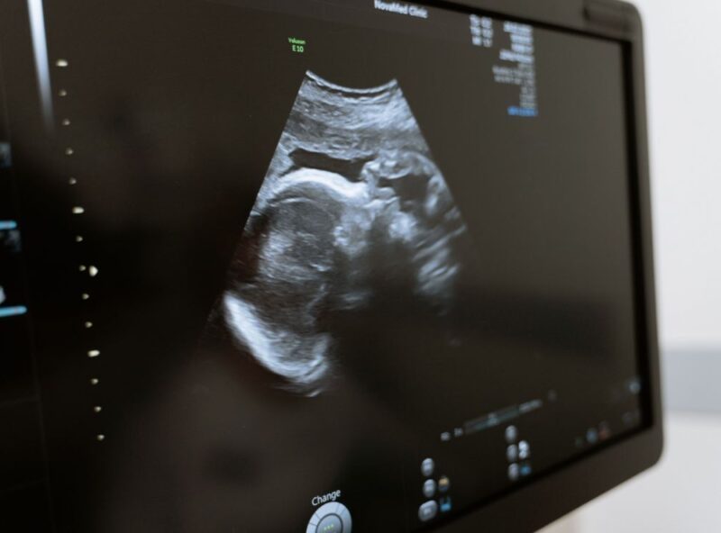 Paraná aprova lei que obriga hospitais a relatar dados sobre aborto