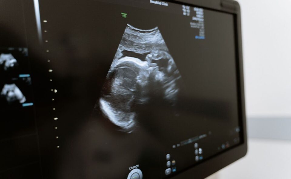 Hospitais do Paraná terão que relatar casos de aborto; veja o que diz projeto de lei aprovado