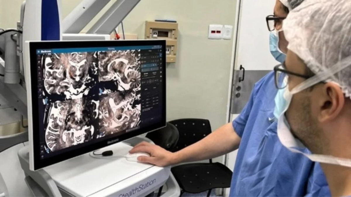 Hospital de Curitiba realiza pela 1ª vez cirurgia que melhora qualidade de vida de pacientes com Parkinson
