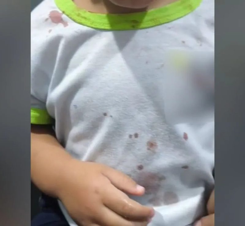 Prisão de padrasto em Palotina após menina de 2 anos ir ferida à creche