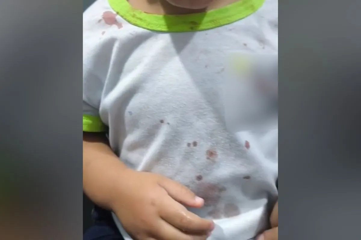 Menina de 2 anos encontrada com hematomas e sangue na roupa no Paraná morava com padrasto suspeito de agressão há dois meses