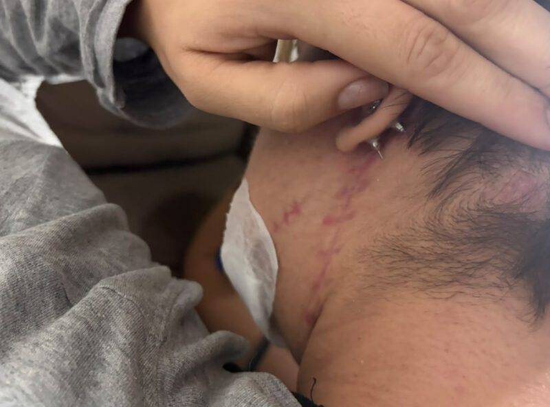 Mulher baleada no rosto pelo ex em Curitiba luta por recuperação