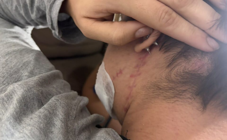 Mulher baleada no rosto pelo ex em salão de Curitiba segue em reabilitação com sequelas na fala, e mãe cobra justiça