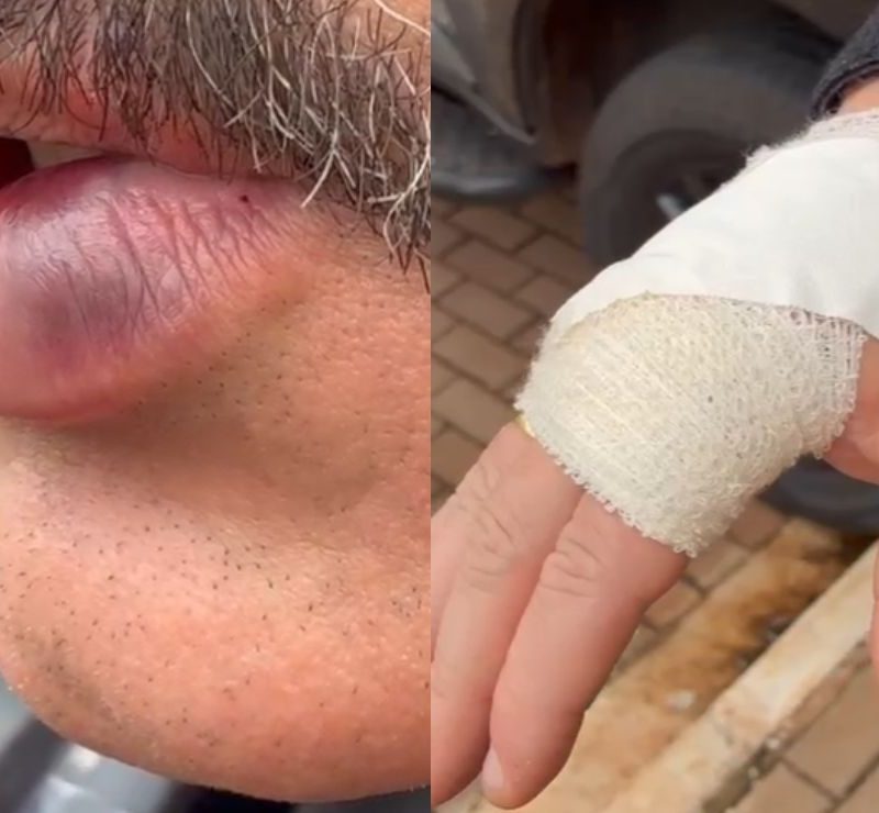 Guarda municipal é agredido com soco no rosto por homem em surto no Paraná