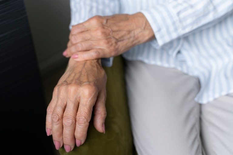 Saúde: osteoporose pode evoluir sem sintomas e aumentar o risco de fraturas